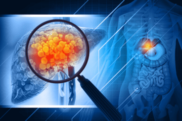 Multi-modal Image Acquisition and Processing Expertise in MASH and Obesity Assessments
